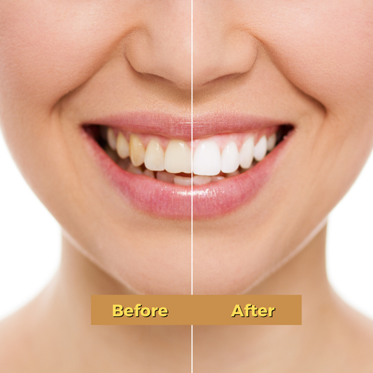 Organic Magical Teeth Whitening Kit | Miswak Toothbrush and Teeth Whitening Powder